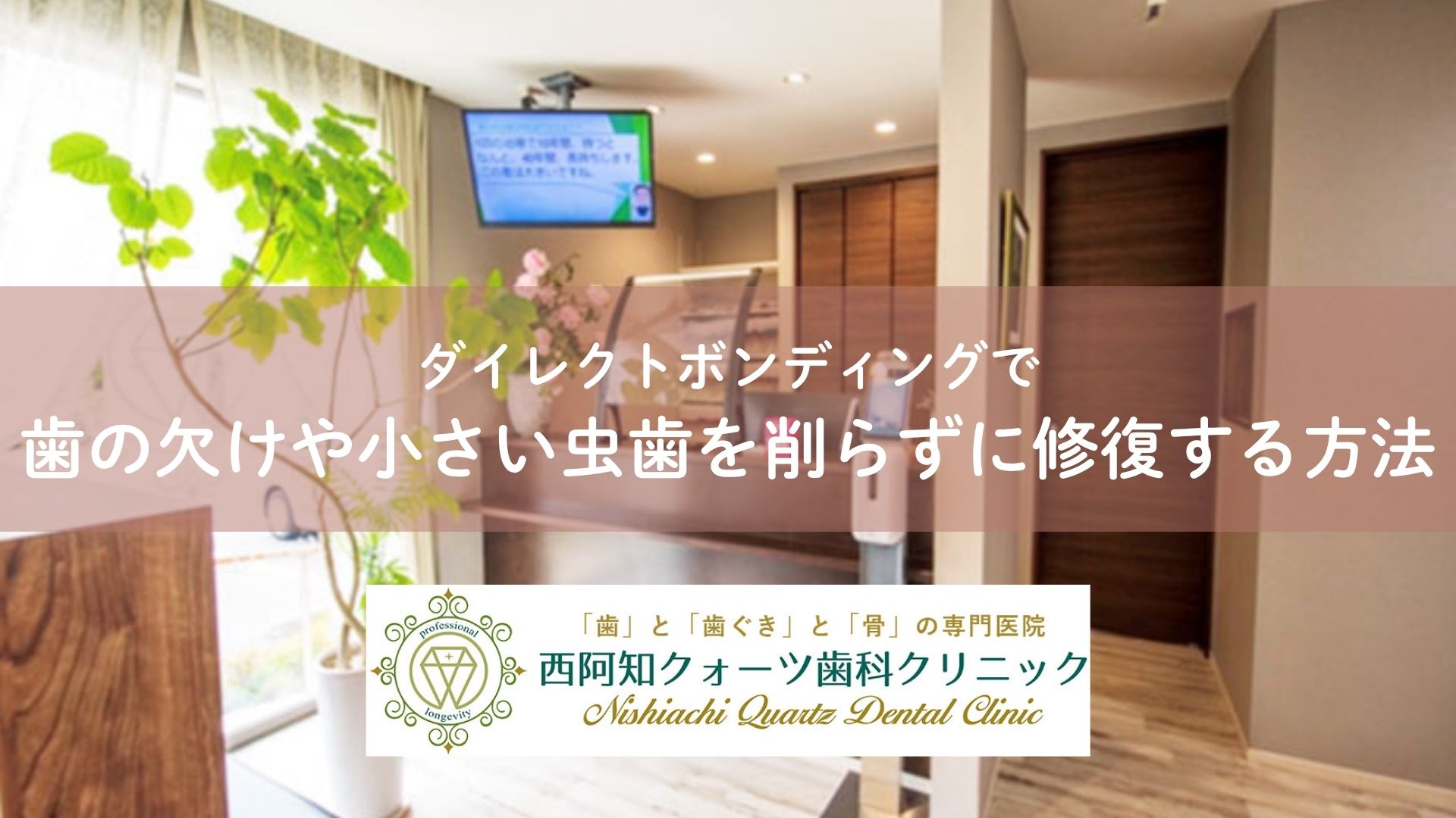 ダイレクトボンディングで歯の欠けや小さい虫歯を削らずに修復する方法