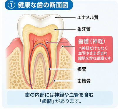 「根管治療」と「抜髄」は同じ?歯の神経を残すことの大切さ